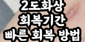 2도화상 회복기간