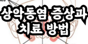 상악동염 증상과 치료 방법