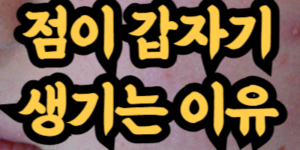 점이 갑자기 생기는 이유