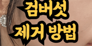 검버섯 제거하는 방법